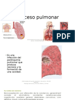 Absceso Pulmonar