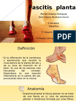 Fascitis Plantar