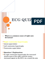 ECG Quiz