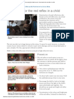 Community Eye Health Journal How To Test For The Red Reflex in A Child 2014