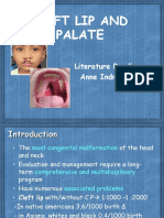 Cleft Lip and Palate