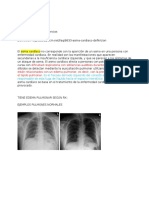 Posible Asma Cardiaco, Caso Procesos II