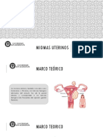 Miomas Uterinos