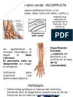 Fractura Tallo Verde y Femur.