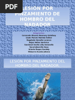 Lesión Por Pinzamiento de Hombro Del Nadador