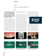 AWB - ParaPost ParaCore - E - Paul PDF