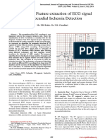 Analysis and Feature Extraction of ECG Signal For Myocardial Ischemia Detection