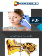 OTOPLASTIA