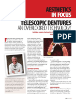 Telescopic Dentures: An Overlooked Technology