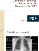 Gambaran Radiologi Thorax