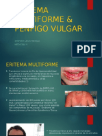 Eritema Multiforme & Pénfigo Vulgar