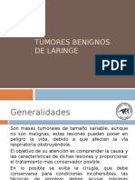 Tumores Benignos de Laringe