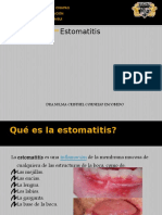 Estomatitis