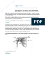 Shoulder Joint Replacement