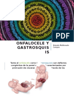 Onfalocele y Gastrosquisis