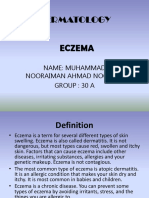 Eczema