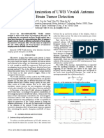 Design and Optimization of UWB Vivaldi Antenna For Brain Tumor Detection