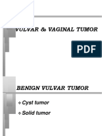 Vulvar and Vaginal Tumor