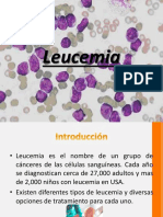 Leucemias y Linfomas en Pediatria