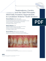 Adhesive Restorations, Centric Relation and The Dahl Principle