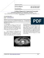 Scholars Journal of Medical Case Reports: ISSN 2347-6559 (Online) ISSN 2347-9507 (Print)