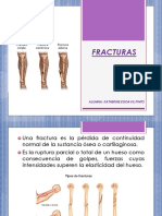 Fracturas