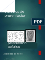 Distocias de Presentacion