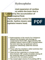 Hydrocephalus