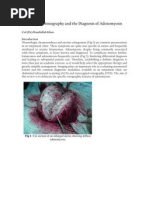 Transvaginal Sonography and The Diagnosis of Adenomyosis: Col (DR) Hanifullah Khan