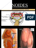 ADENOIDES