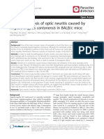 The Pathogenesis of Optic Neuritis Caused by Angiostrongylus Cantonensis in BALB/c Mice