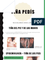 Tiña Pedís