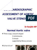 Echocardiographic Assessment of Aortic Valve Stenosis DR Ranjit