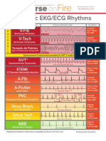 Basic EKG ECG Rhythms Cheatsheet