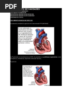 Crecimiento de Cavidades - Ecg