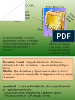 Apendicitis Aguda