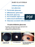 30secondary Glaucomas