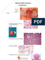 Examen Anatomía Patologica Junio 2012 Grado
