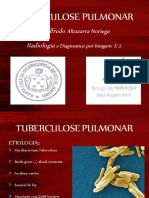 Tuberculose Pulmonar: Alfredo Radiologia