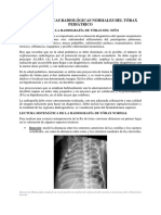 Características Radiológicas Normales Del Tórax Pediátrico - 4ta Consulta