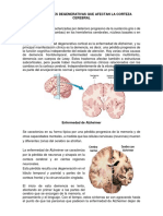 Enfermedades Degenerativas Que Afectan La Corteza Cerebral