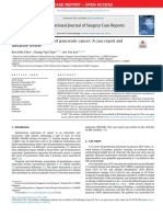 Spontaneous Regression of Pancreatic Cancer: A Case Report and Literature Review