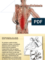 ESPONDILOSINTESIS