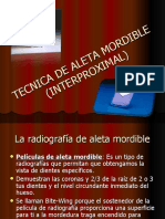 Tecnica de Aleta Mordible (Interproximal)