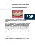 Articulos Sobre Oclusion en Implantologia