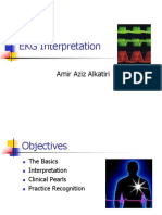 EKG Interpretation: Amir Aziz Alkatiri