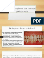 Etiopatogênese Das Doenças Periodontais 