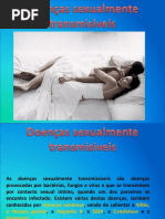 Doenças Sexualmente Transmisiveis