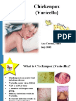 Chickenpox Presentation 1209266936137555 9