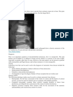 Metastase Bone Disease